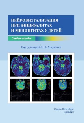 Нейровизуализация при энцефалитах и менингитах у детей