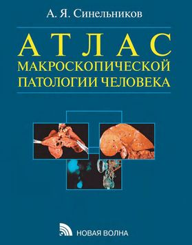 Атлас макроскопической патологии человека